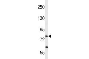 Western Blotting (WB) image for anti-Solute Carrier Family 28 (Sodium-Coupled Nucleoside Transporter), Member 2 (SLC28A2) antibody (ABIN2998577) (SLC28A2 antibody)