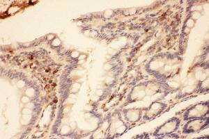 Anti-MMP7 Picoband antibody,  IHC(P): Rat intestines Tissue (MMP7 antibody  (AA 95-264))