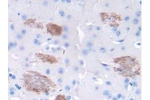 Immunohistochemistry (IHC) image for anti-Tumor Necrosis Factor alpha (TNF alpha) (AA 80-235) antibody (ABIN7427663)