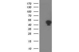 HEK293T cells were transfected with the pCMV6-ENTRY control (Left lane) or pCMV6-ENTRY TMOD1 (Right lane) cDNA for 48 hrs and lysed. (Tropomodulin 1 antibody)
