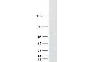 RAB40A Protein (Myc-DYKDDDDK Tag)