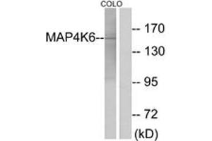 Western blot analysis of extracts from COLO cells, using MAP4K6 Antibody. (MAP4K6 antibody  (AA 401-450))