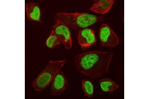 IF analysis of VPRBP/DCAF1 using anti-VPRBP/DCAF1 antibody (ABIN7602005). (DDB1 and CUL4-Associated Factor 1 (DCAF1) (AA 540-861) antibody)