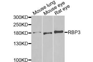 Western blot analysis of extracts of various cell lines, using RBP3 antibody. (RBP3 antibody)