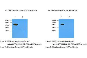 Transfected and non-transfected 293T cell lysates were resolved by SDS-PAGE, transferred to nitrocellulose membrane and probed with anti- ORF73/HHV8 (1:1,000) and anti-MBP (1:1,000). (HHV 8 (AA 122-329) antibody)