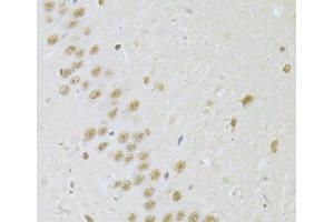 Immunohistochemistry of paraffin-embedded Rat brain using SNRPA Polyclonal Antibody at dilution of 1:100 (40x lens). (SNRPA1 antibody)