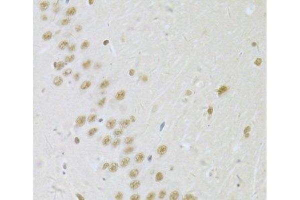 SNRPA1 antibody