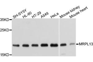 Western blot analysis of extracts of various cell lines, using MRPL13 antibody (ABIN1877008) at 1:1000 dilution.
