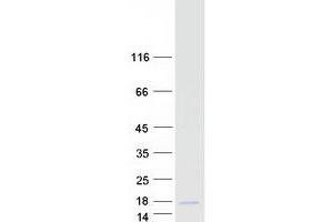 Western Blotting (WB) image for Calcitonin-Related Polypeptide beta (CALCB) protein (Myc-DYKDDDDK Tag) (ABIN2713949)