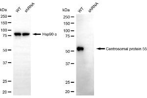 Western blotting analysis using centrosomal protein 55 antibody (ABIN7798025). (CEP55 antibody)