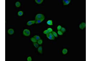 Immunofluorescent analysis of PC-3 cells using ABIN7169471 at dilution of 1:100 and Alexa Fluor 488-congugated AffiniPure Goat Anti-Rabbit IgG(H+L)