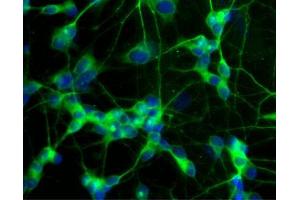 Immunofluorescent staining of differentiated SH-SY5Y cells. (MAP2 antibody  (AA 19-219))