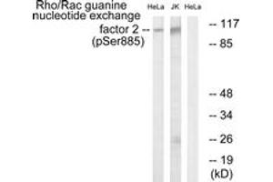 Western blot analysis of extracts from HeLa cells treated with TSA 400nM 24H and Jurkat cells treated with forskolin 40nM 30', using Rho/Rac Guanine Nucleotide Exchange Factor 2 (Phospho-Ser885) Antibody. (ARHGEF2 antibody  (pSer885))