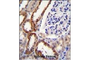 RS2 Antibody (C-term) (ABIN6242575 and ABIN6577319) immunohistochemistry analysis in formalin fixed and raffin embedded human kidney tissue followed by peroxidase conjugation of the secondary antibody and DAB staining. (PARS2 antibody  (C-Term))