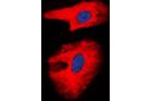 Immunofluorescent analysis of Collagen 1 alpha 2 staining in A431 cells. (COL1A2 antibody  (Center))