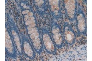 Immunohistochemistry (IHC) image for anti-beta-2-Microglobulin (B2M) (AA 22-119) antibody (ABIN7429220)