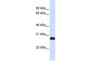 Western Blotting (WB) image for anti-serine Peptidase Inhibitor, Kunitz Type, 2 (SPINT2) antibody (ABIN2459311) (SPINT2 antibody)