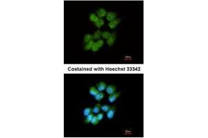 ICC/IF Image Immunofluorescence analysis of methanol-fixed A431, using Slap, antibody at 1:200 dilution. (SLA antibody)