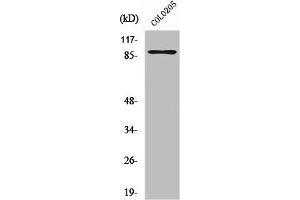 Western Blot analysis of COLO205 cells using Rap1GAP Polyclonal Antibody