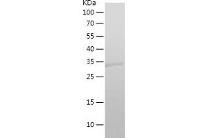 Western Blotting (WB) image for Small Proline-Rich Protein 2F (SPRR2F) (AA 1-72) protein (His-IF2DI Tag) (ABIN7282584) (SPRR2F Protein (AA 1-72) (His-IF2DI Tag))