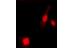 Immunofluorescent analysis of NF-kappaB p105/p50 (pS337) staining in MCF7 cells. (NFKB1 antibody  (pSer337))
