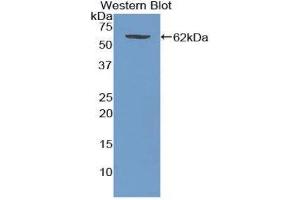 Western Blotting (WB) image for anti-Wingless-Type MMTV Integration Site Family, Member 5A (WNT5A) (AA 62-380) antibody (ABIN1078673) (WNT5A antibody  (AA 62-380))
