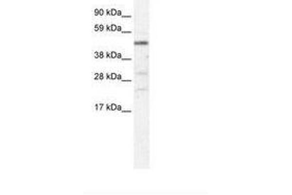 HSFY1 Antikörper  (AA 97-146)