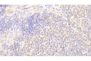 Detection of BLK in Human Lymph node Tissue using Polyclonal Antibody to B-Lymphoid Tyrosine Kinase (BLK) (BLK antibody  (AA 241-494))