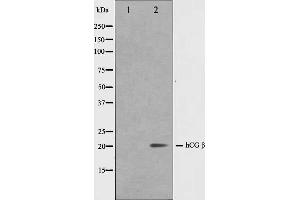 Western blot analysis on NIH-3T3 cell lysate using hCG beta Antibody,The lane on the left is treated with the antigen-specific peptide. (HCG beta antibody)