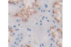 IHC-P analysis of Human Tissue, with DAB staining. (IL12RB1 antibody  (AA 429-603))