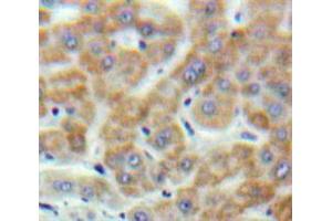Used in DAB staining on fromalin fixed paraffin-embedded Liver tissue (Motilin antibody  (AA 26-115))