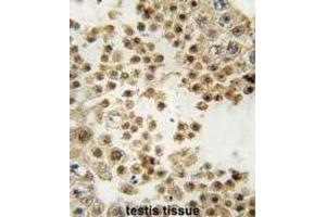 Immunohistochemistry (IHC) image for anti-Parkinson Protein 2, E3 Ubiquitin Protein Ligase (Parkin) (PARK2) antibody (ABIN3002636) (Parkin antibody)