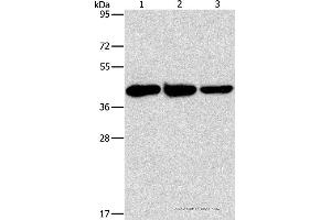 Western blot analysis of Human normal liver tissue, mouse brain and heart tissue, using GOT1 Polyclonal Antibody at dilution of 1:1600 (GOT1 antibody)