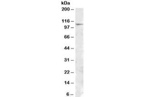 Western blot testing of human substantia nigra lysate with MTHFD1 antibody at 1ug/ml. (MTHFD1 antibody)
