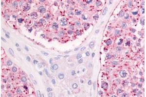 Human Testis (formalin-fixed, paraffin-embedded) stained with GPR68 antibody ABIN213456 at 10-20 ug/ml followed by biotinylated goat anti-rabbit IgG secondary antibody ABIN481713, alkaline phosphatase-streptavidin and chromogen. (GPR68 antibody  (Extracellular Domain))