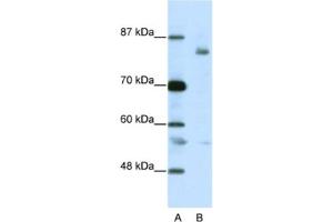 Western Blotting (WB) image for anti-Leucine-Zipper-Like Transcription Regulator 1 (LZTR1) antibody (ABIN2461800)