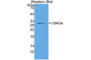 Western Blotting (WB) image for anti-Matrix Metallopeptidase 14 (Membrane-inserted) (MMP14) (AA 322-541) antibody (ABIN1980455) (MMP14 antibody  (AA 322-541))