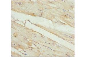 Immunohistochemistry of paraffin-embedded human skeletal muscle tissue using ABIN7157248 at dilution of 1:100 (KBTBD3 antibody  (AA 1-350))