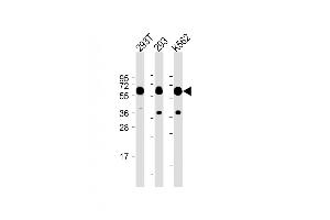 All lanes :SET07 Antibody at 1:2000 dilution Lane 1: 293T whole cell lysate Lane 2: 293 whole cell lysate Lane 3: K562 whole cell lysate Lysates/proteins at 20 μg per lane. (SETD8 antibody  (N-Term))