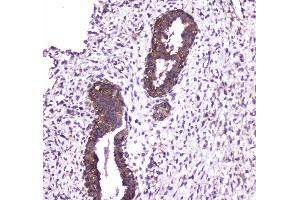 IHC analysis of Caspase 4 using anti-Caspase 4 antibody . (Caspase 4 antibody  (AA 111-194))