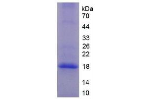 SDS-PAGE (SDS) image for Complement Factor P (CFP) (AA 310-459) protein (His tag) (ABIN1170213) (CFP Protein (AA 310-459) (His tag))