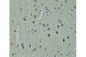 Immunohistochemistry of paraffin-embedded Rat brain using UBE2I Polyclonal Antibody at dilution of 1:100 (40x lens). (UBE2I antibody)