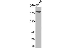 Western Blot analysis of Colo205 cells using MADD Polyclonal Antibody (MADD antibody  (Internal Region))