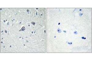 Immunohistochemistry analysis of paraffin-embedded human brain tissue, using ADORA2A Antibody. (Adenosine A2a Receptor antibody  (AA 120-169))