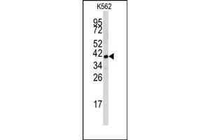 Image no. 1 for anti-Fibrillarin (FBL) (Middle Region) antibody (ABIN357938) (Fibrillarin antibody  (Middle Region))