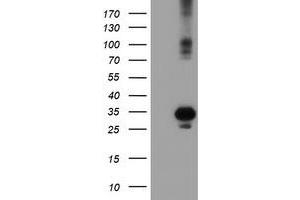 Western Blotting (WB) image for anti-Suppressor of Cytokine Signaling 3 (SOCS3) antibody (ABIN1501063) (SOCS3 antibody)