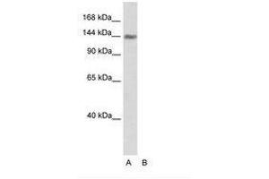 Image no. 1 for anti-Timeless Homolog (TIMELESS) (C-Term) antibody (ABIN202978)