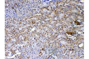Immunohistochemistry (IHC) image for anti-X-Ray Repair Complementing Defective Repair in Chinese Hamster Cells 1 (XRCC1) (AA 538-633) antibody (ABIN5693138)