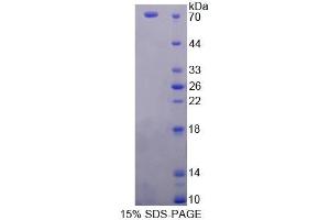 Image no. 1 for Protoporphyrinogen Oxidase (PPOX) (AA 12-471) protein (His tag,GST tag) (ABIN4990491)