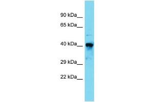 Host:  Rabbit  Target Name:  Rara  Sample Type:  Mouse Kidney lysates  Antibody Dilution:  1.